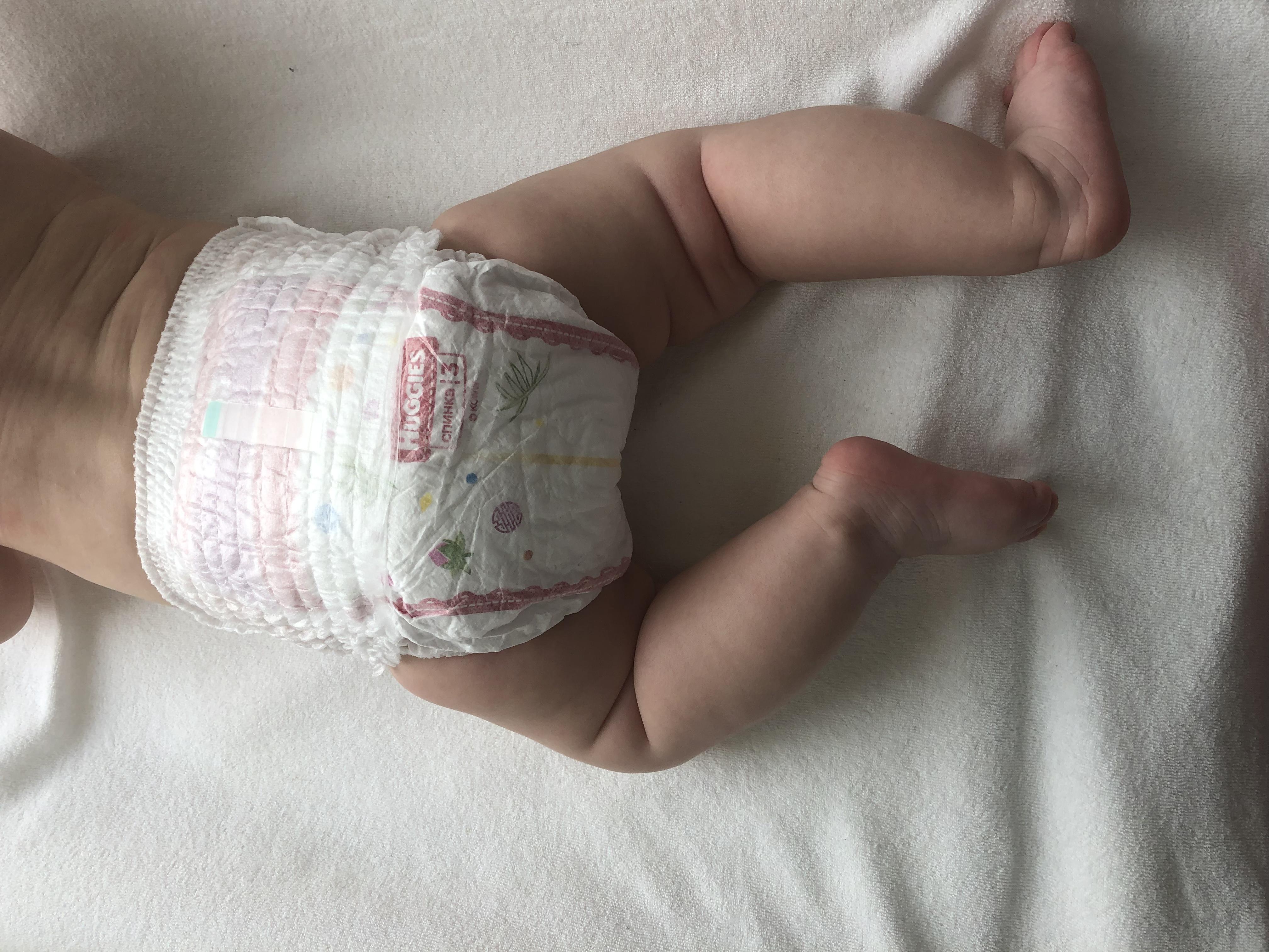 Как выглядит аллергия на подгузники фото Как выглядит аллергия на подгузники фото